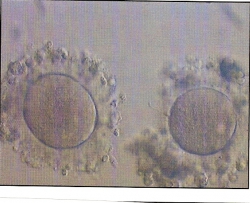 In vitro gereifte Eizellen II